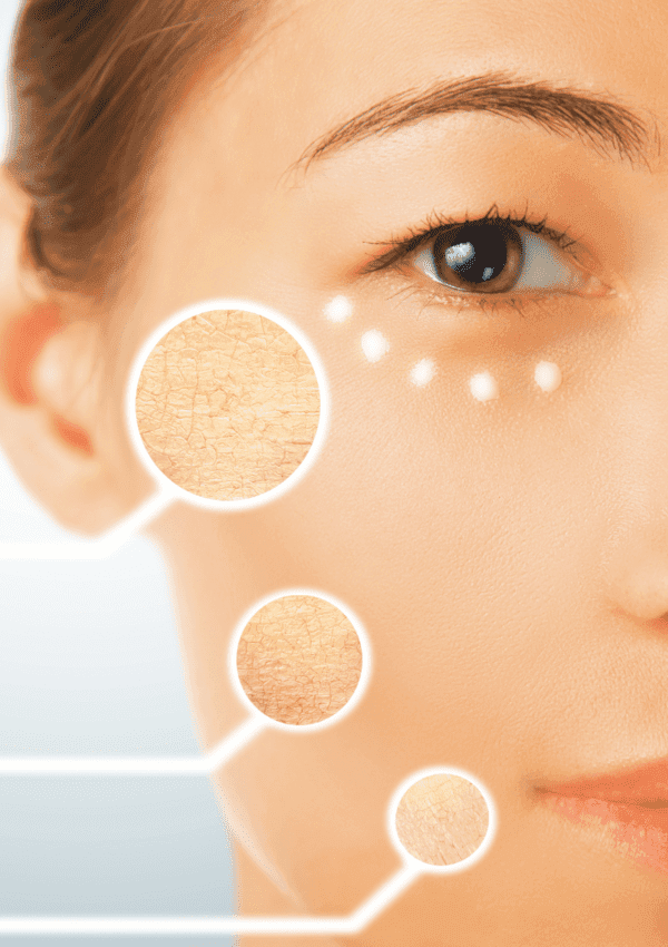 Comparativa de las mejores cremas hidratantes para piel seca y sus beneficios