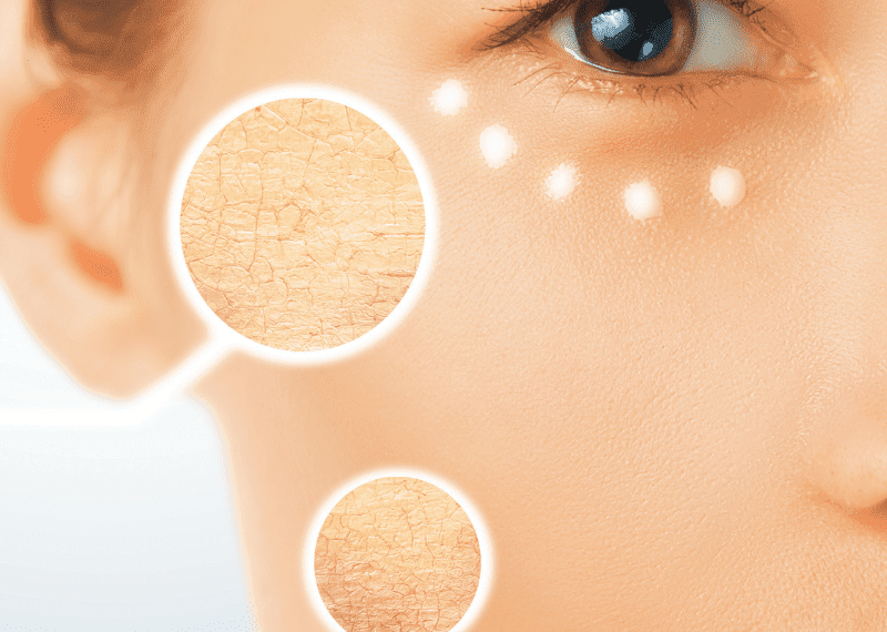 Comparativa de las mejores cremas hidratantes para piel seca y sus beneficios