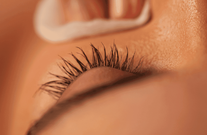 Mujer con piel grasa usando un algodón para retirar el exceso de sebo del rostro