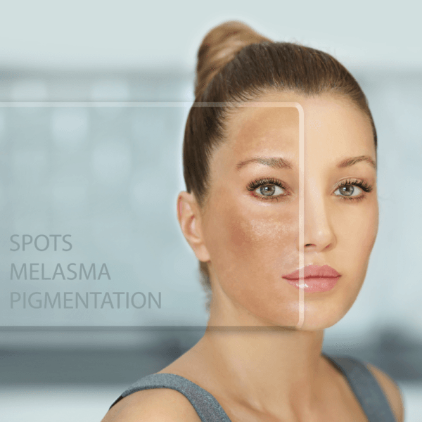 Manchas en la piel: la guía definitiva y efectiva para tratarlas en 2025