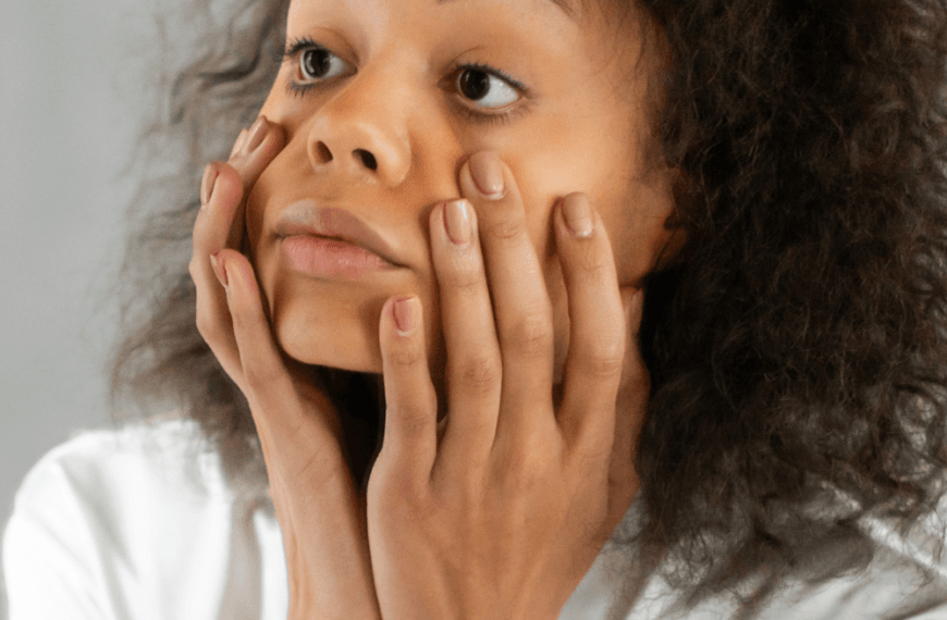 Solucion ojeras y bolsas. Mujer con ojeras y bolsas en los ojos, tocando su rostro con preocupación