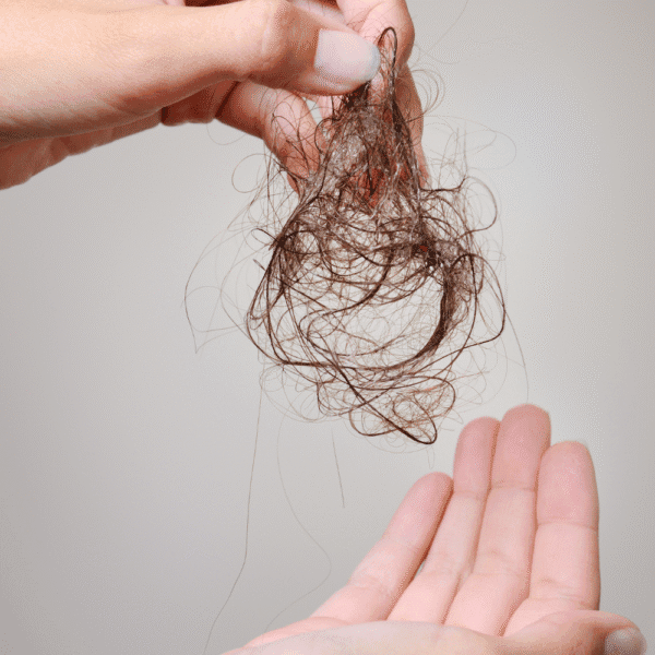 Caída estacional del cabello: lo que nadie te cuenta