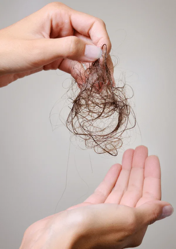 Caída estacional del cabello